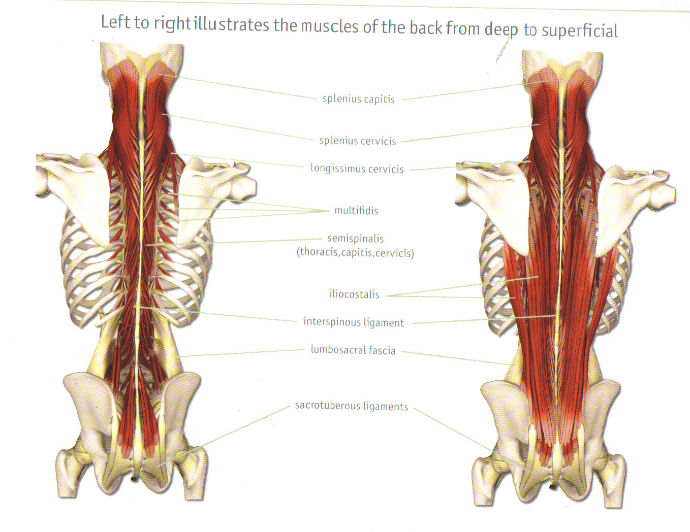 Латеральные мышцы спины. Крестцово остистая мышца. Длинные мышцы. Длинные мышцы спины. Поперечно остистая мышца.